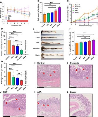 Probiotic Cocktail Alleviates Intestinal Inflammation Through Improving Gut Microbiota and Metabolites in Colitis Mice